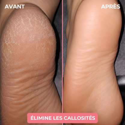 Râpe électrique anti-callosités