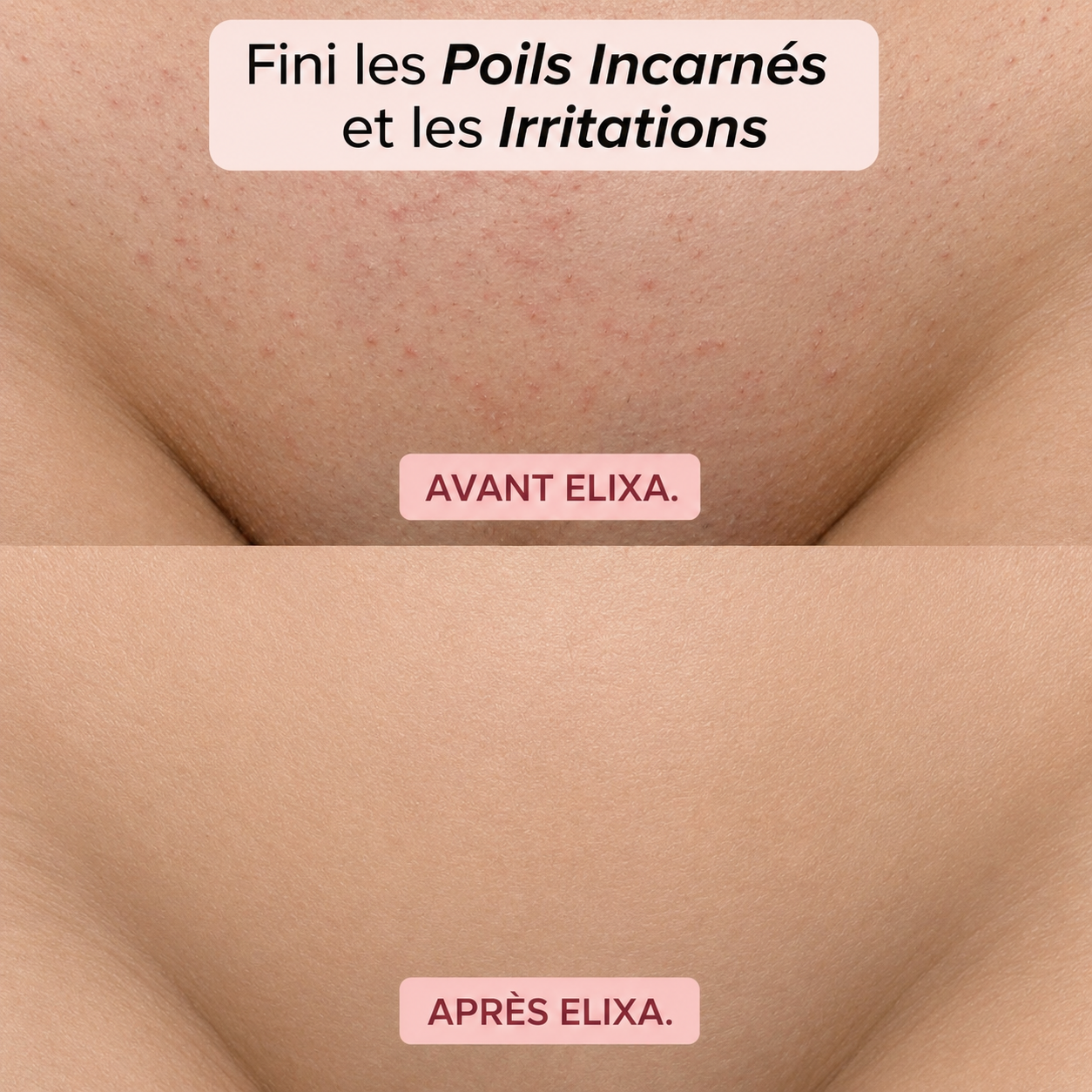ÉPILATEUR 2 EN 1 POUR LE BIKINI ET LE CORPS ELIXA