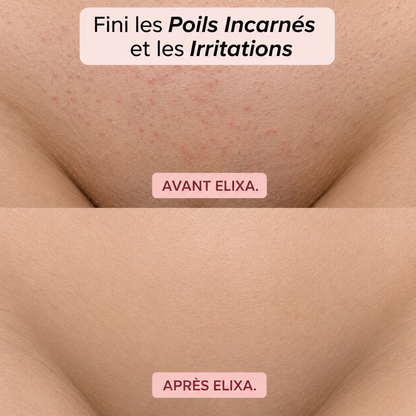 ÉPILATEUR 2 EN 1 POUR LE BIKINI ET LE CORPS ELIXA