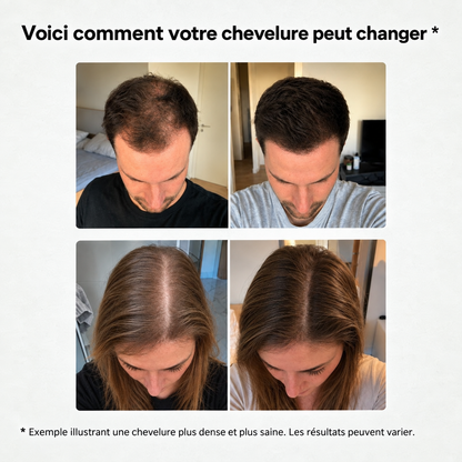 Huile Capillaire Bio Croissance+