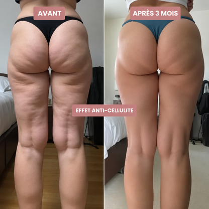 Legging Anti-Cellulite Elixa