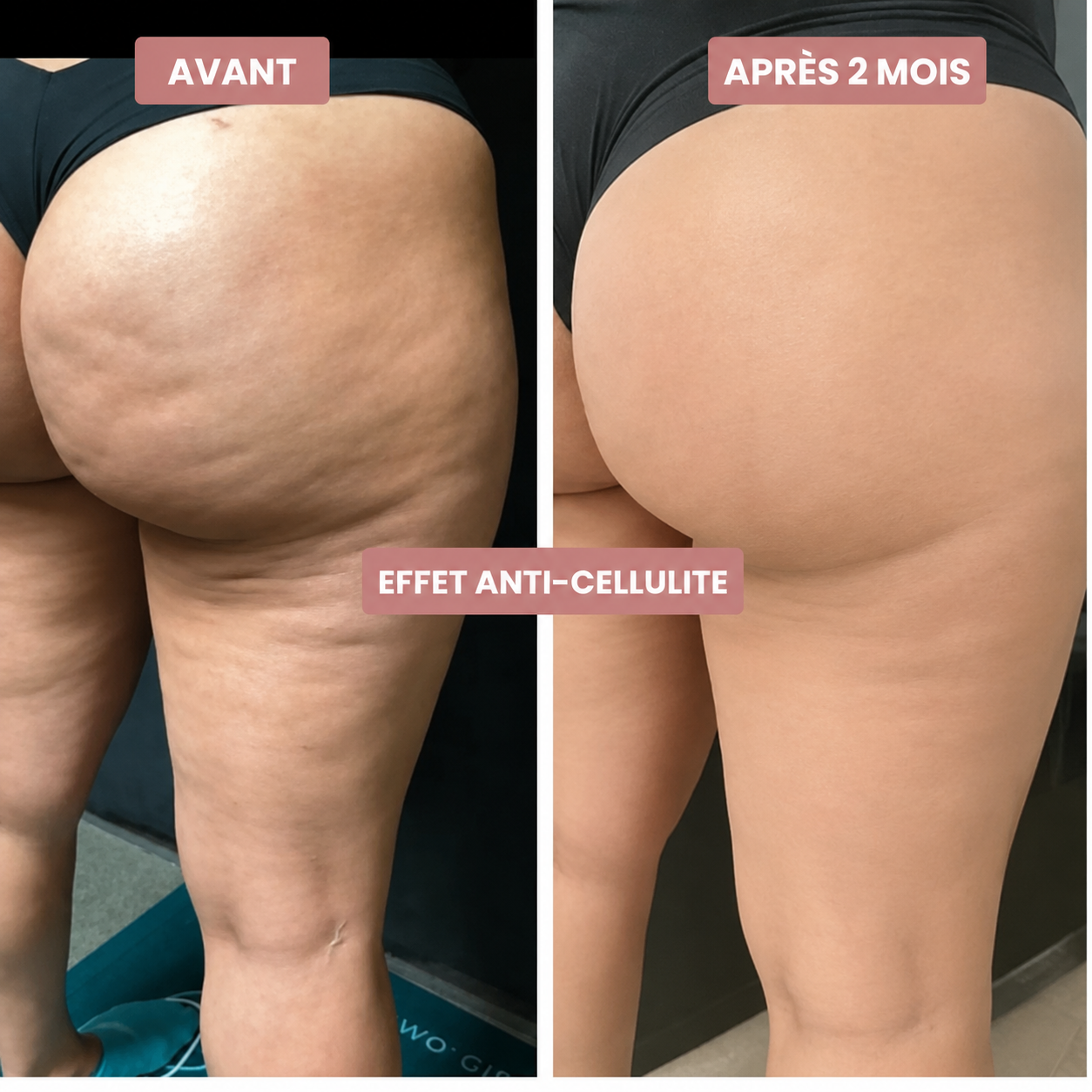 Legging Anti-Cellulite Elixa
