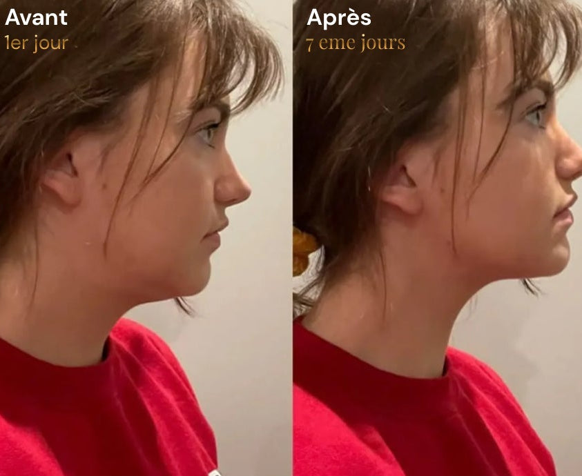 Elixa- brosse Sculptante Lymphatique