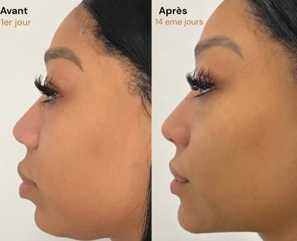 Elixa- brosse Sculptante Lymphatique