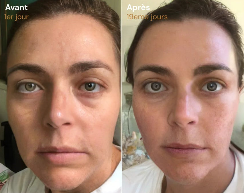 Elixa- brosse Sculptante Lymphatique