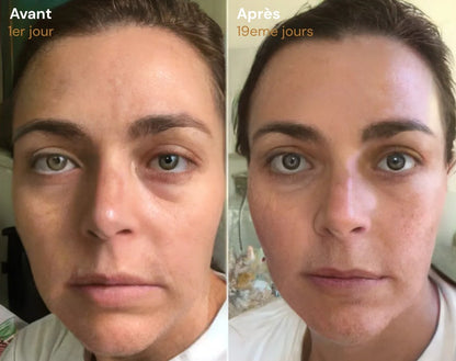 Elixa- brosse Sculptante Lymphatique