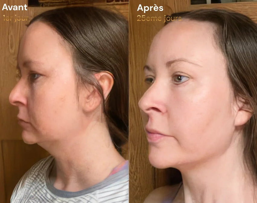 Elixa- brosse Sculptante Lymphatique