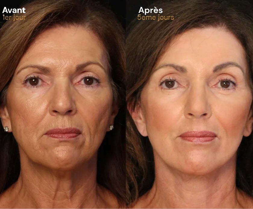 Elixa- brosse Sculptante Lymphatique