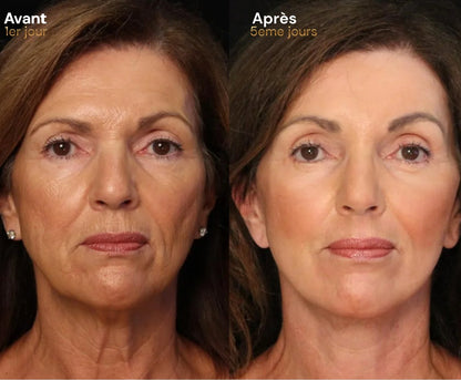 Elixa- brosse Sculptante Lymphatique