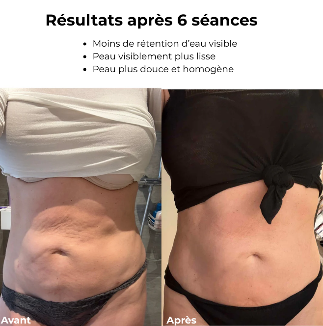 CelluLift