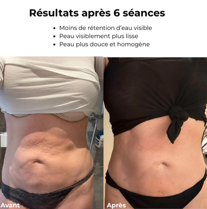CelluLift