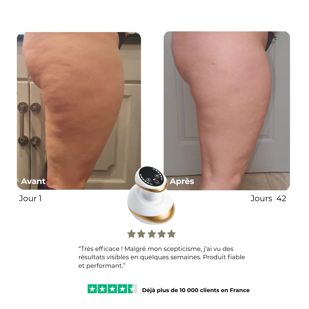 CelluLift