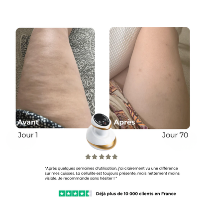 CelluLift