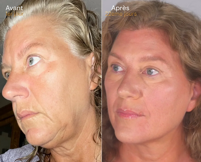 Elixa- brosse Sculptante Lymphatique