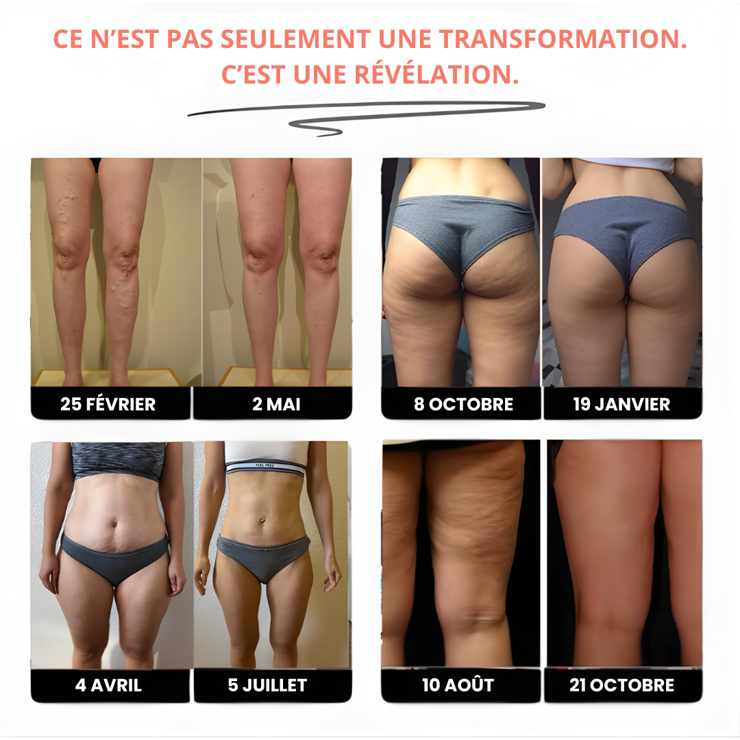 Leggings anti cellulite – Redéfinis ta silhouette sans effort