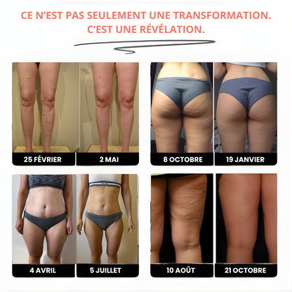 Leggings anti cellulite – Redéfinis ta silhouette sans effort