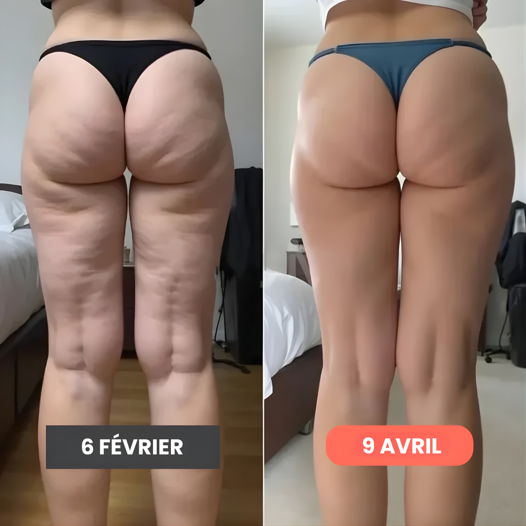 Leggings anti cellulite – Redéfinis ta silhouette sans effort