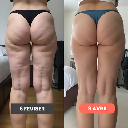 Leggings anti cellulite – Redéfinis ta silhouette sans effort