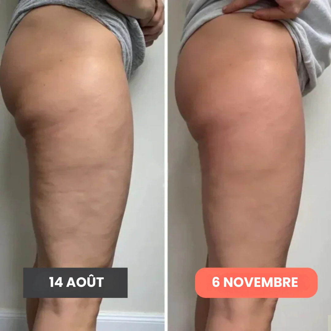 Leggings anti cellulite – Redéfinis ta silhouette sans effort